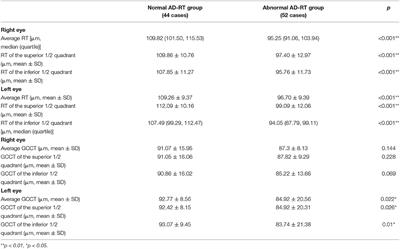 The Relationship Between Retinal Nerve Fiber Layer Thickness and Clinical Symptoms of Alzheimer's Disease